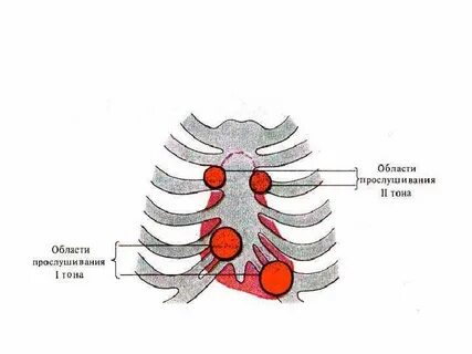 Аускультация сердца тоны