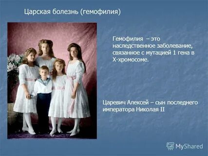 Царская болезнь