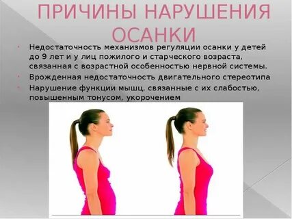 Что не является причиной нарушения осанки