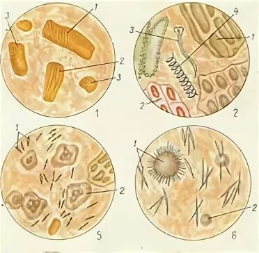 Грибы в копрограмме у взрослого. Микроскопия кала копрограмма. Копрологическое исследование микроскопия препаратов кала. Соединительная ткань кал копрограмма. Микроскопия кала мышечные волокна.