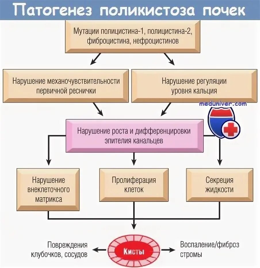 Механизм развития поликистоза почек. Врожденный поликистоз почек патогенез. Патогенез поликистоза почек. Этиология поликистоза почек. Патогенез почки