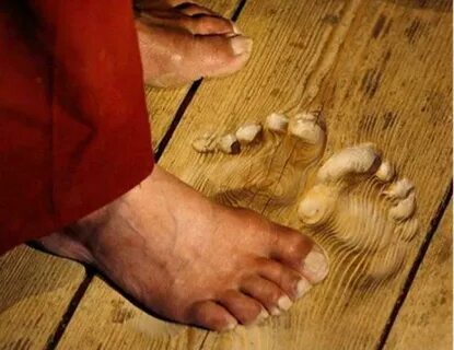 Остаются следы на ногах