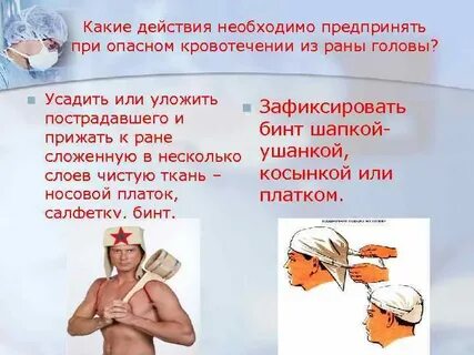 При кровотечении из раны головы прижимают