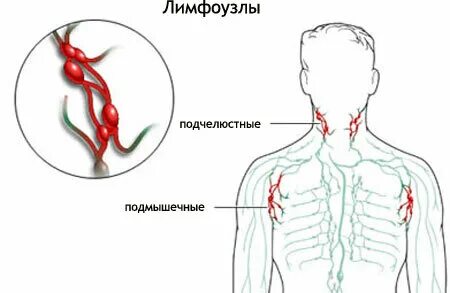 Лимфоузлы инфекции