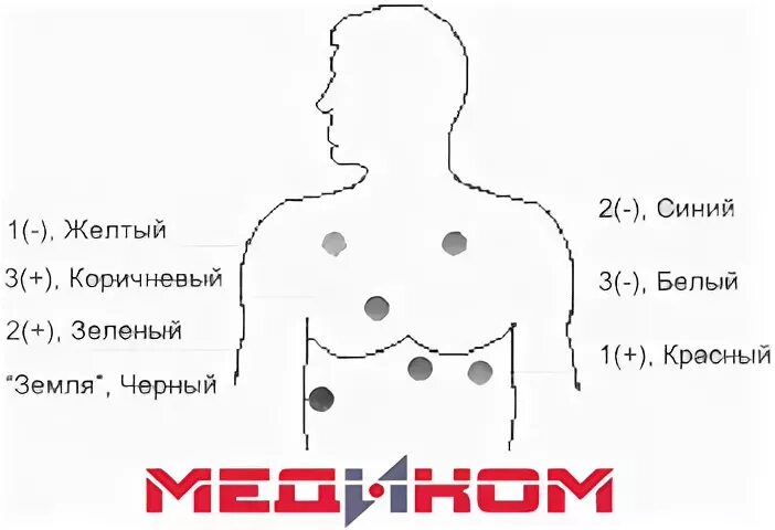 Холтер схема расположения датчиков Холтеровское мониторирование Холтеровское.. "Медпрактика", сеть медицинских цент