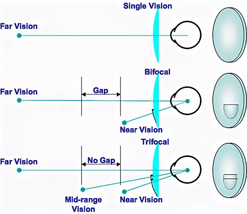 Single vision. Trifocal Smart Lenses. Near and far Vision. Spectacle Lens Polishing.