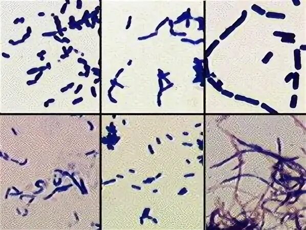 Corynebacterium spp в мазке у мужчин. Мобилункус микробиология. мобилункус в женском мазке. мобилункус в мазке у женщин. mobiluncus spp corynebacterium лечение.