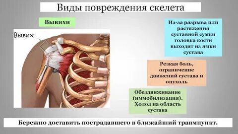 Выход кости