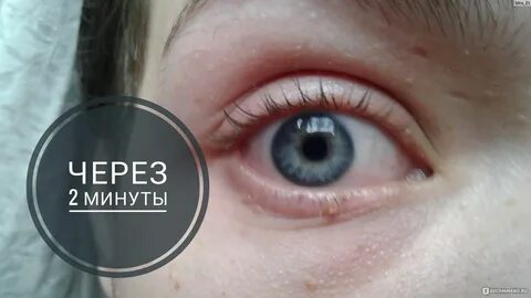 Как отбелить белки глаз от желтизны