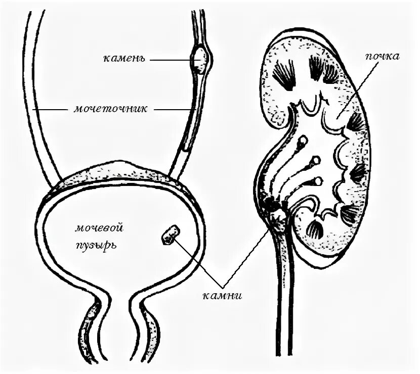 Мочеточники млекопитающих. Мочекаменная болезнь Ветеринария. Мочекаменная болезнь у пушных зверей. Мочевыделительная система кошки анатомия. Этиология мочекаменной болезни у животных.