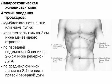 Ниже и правее пупка