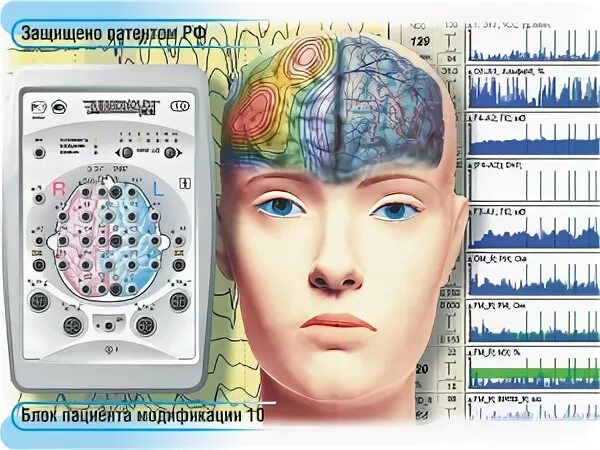 Ээга 21. Энцефалограф Энцефалан 131-03. Электроэнцефалограф-анализатор ЭЭГА-21/26- Энцефалан-131-03. Электроэнцефалограф ЭЭГА-21/26 «Энцефалан-131-03. Энцефалан-131-03.