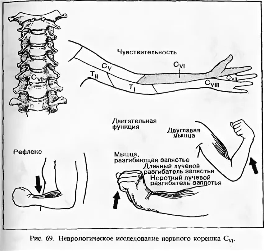 Сухожильные рефлексы надкостничные рефлексы. Исследование рефлексов неврология. Исследование рефлекторно-двигательных функций. Методы исследования двигательных рефлексов.