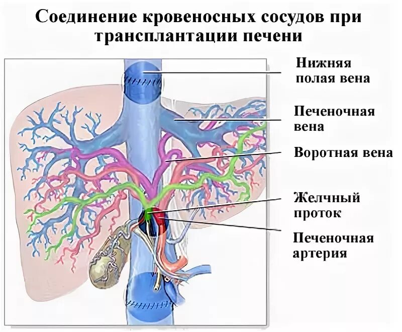 Трансплантация печени. Кровеносные сосуды печени. Пересадка части печени.