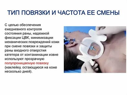 Смена повязки