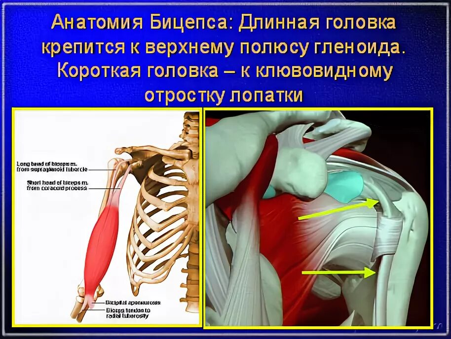 Тендинит сухожилия головки бицепса. Теносиновит плечевого сухожилия. теносиновита сухожилия длинной головки двуглавой мышцы плеча. повреждение сухожилия длинной головки двуглавой мышцы. разрыв сухожилия плечевого бицепса.