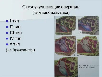 Операции 3 типа