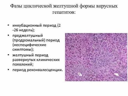 Вирусный гепатит формы