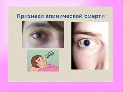 Кошачий глаз признака клинической
