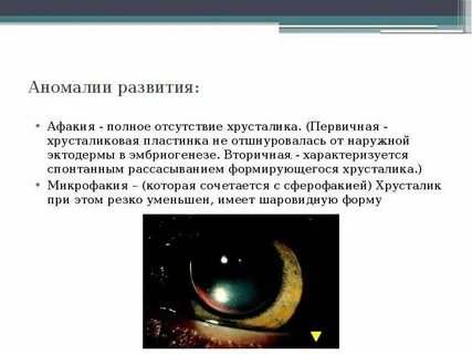 Афакия это