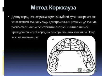 Верхний тон