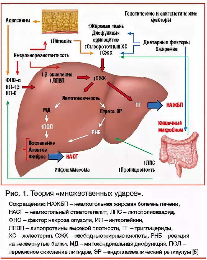 Печень больная жировой. Жировой гепатоз печени патогенез. Неалкогольная жировая болезнь печени. Патогенез НАЖБП. Неалкогольная жировая болезнь печени этиология.