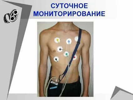 Датчики холтера схема