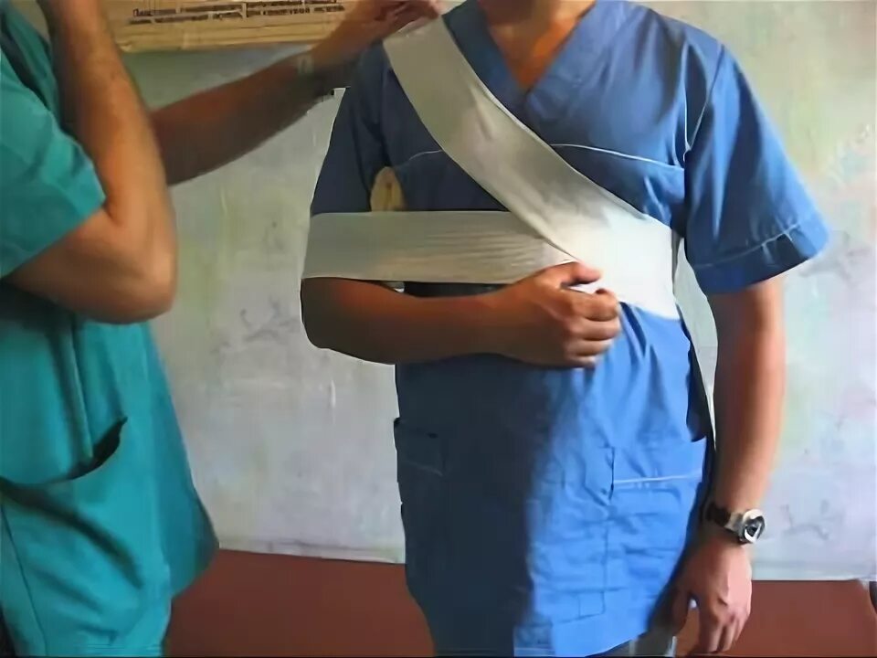 При вывихе плеча применяют повязку спиральную