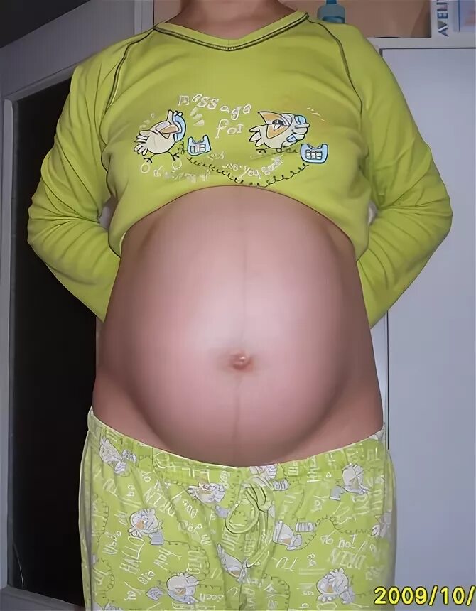 Форма живота беременной мальчиком. Форма живота с мальчиком. Живот на 32 неделе беременности мальчик. 36 неделя фото