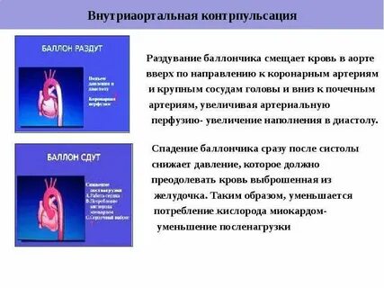 Острая сосудистая недостаточность презентация