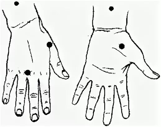 Болевые точки на ладони человека. Акупунктурные точки на руке. Биологически активные точки на руках. Биологически активные точки на руке руки. Точки на запястье руки