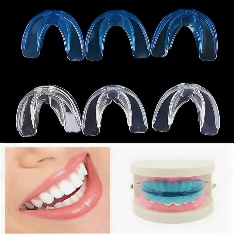 Ритейлеры для зубов как выглядят Had braces as a kid Never wore your retainer Got 100 days Invisalign Express
