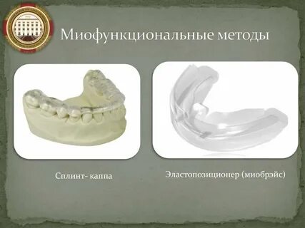 Миофункциональная коррекция