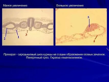 Большое увеличение и малое