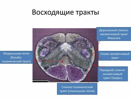 Передний спинно таламический путь