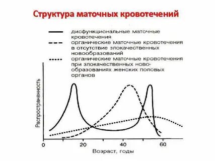 Аномальное ювенильное кровотечение