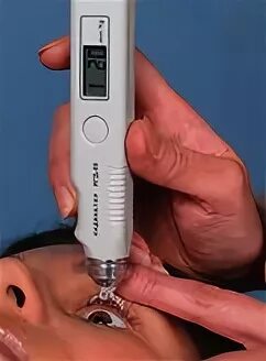 Прибор для измерения внутриглазного давления. Прибор для измерения внутриглазного давления riachert7. Твгд-02. Измерение глазного давления грузиками.