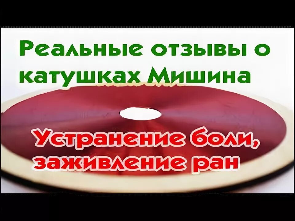 Катушка мишина отзывы. Катушка Мишина. Катушки Мишина при онкологии. Лечебная катушка Мишина болезни. Катушки Мишина отзывы.