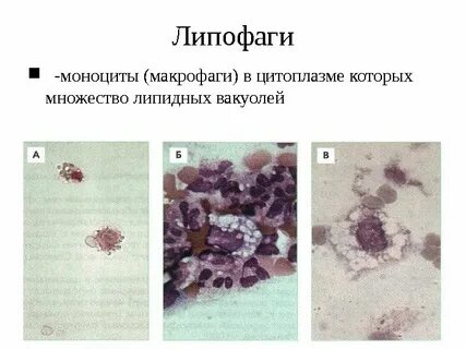 Альвеолярные макрофаги норма