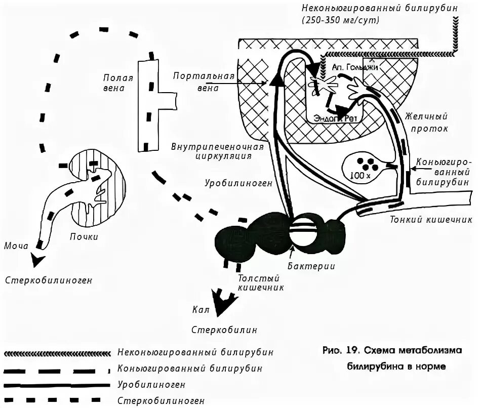показатели желтухи у новорожденных норма. схема конъюгации билирубина. схема нормального пигментного обмена веществ. образование непрямого билирубина. билирубин 350.