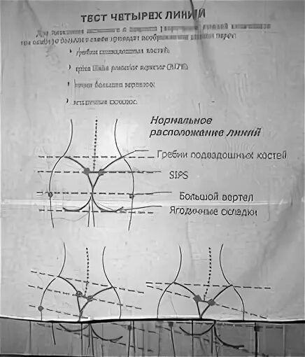 Тест 5 линий таза. Тест пяти линий таза остеопатия. Флексионный тест. Флексионный таз. Тест 5 линий