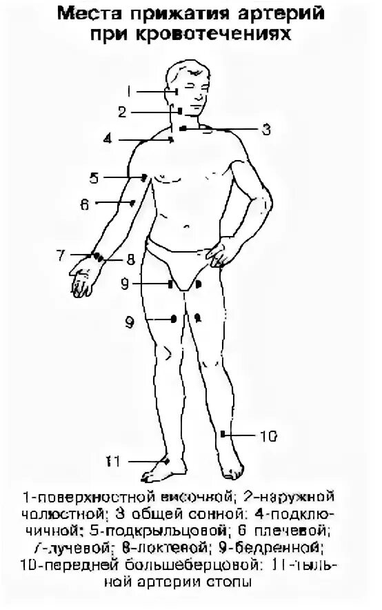 Пальцевое прижатие артерий схема. Точки прижатия артерий схема. Места прижатия артерий при кровотечениях рисунок. Точки прижатия артерий для остановки.
