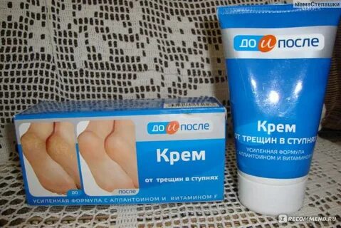 Твинс тэк