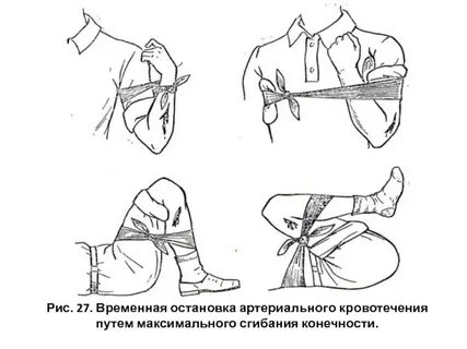 Правильный способ остановки