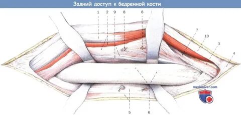 Средняя треть бедра