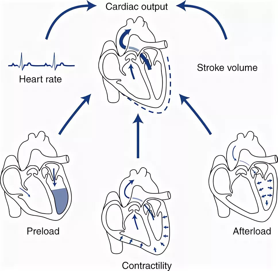 Preload none. Preload heart. preload and afterload. afterload это в сердце. механизм инфаркта миокарда - preload, afterload, contractility.