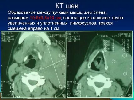 Кт мягких тканей что показывает