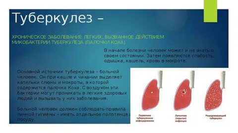 Хронический туберкулез лечение