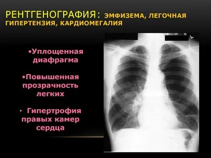 Рентгенография что показывает