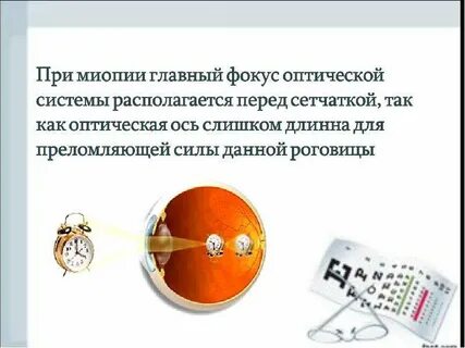 Миопия код